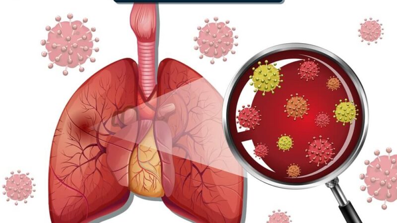 Atipična pljučnica Simptomi: Kako prepoznati in preprečiti